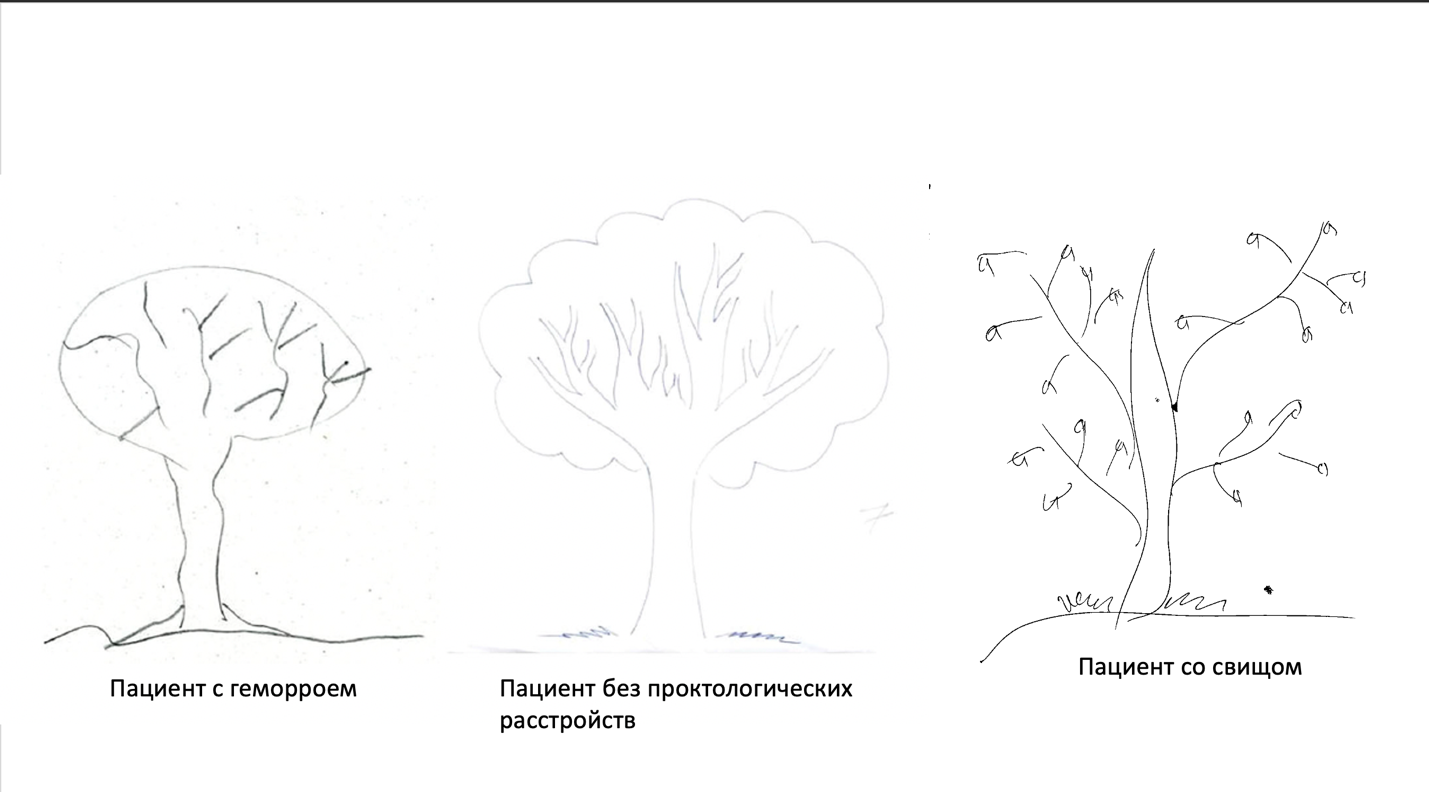 Специфика выполнения теста «дерево»  у пациентов со аноректальным свищом (n=50), геморроем (n=45) и контрольной (здоровой) группы (n=50)