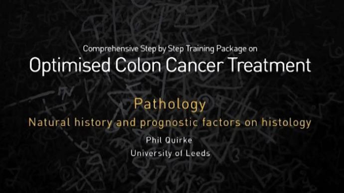 Optimised Colon Cancer Treatment - Прогностические факторы по данным морфологического исследования.