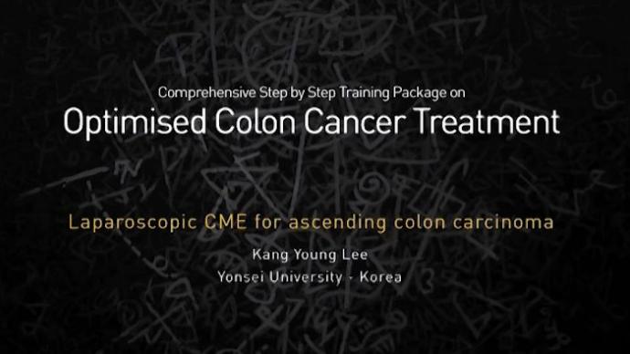 Optimised Colon Cancer Treatment - Лапароскопическая CME восходящей ободочной кишки 