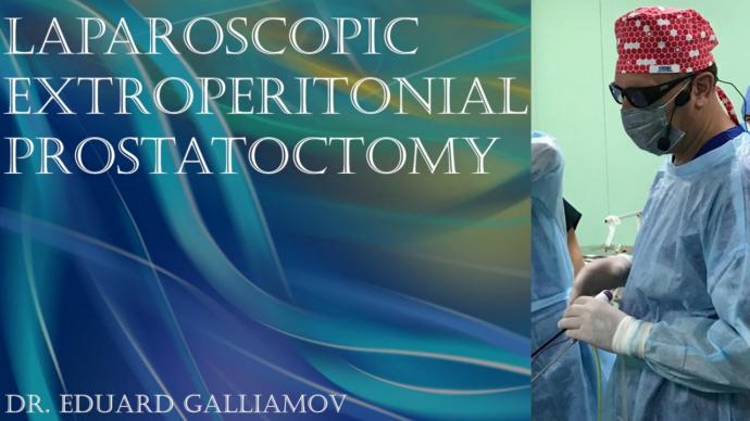 Laparoscopic extroperitonial prostatoctomy