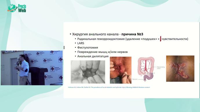 Маркарьян Д.Р. - Проктологические последствия акушерской травмы
