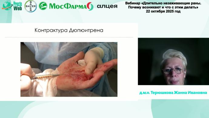 Терюшкова Ж.И. - Современные технологии в лечение постлучевых заболеваний прямой кишки