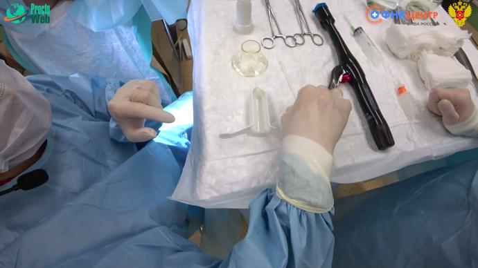 Золотько А.Е. - Циркулярная степлерная геморройдопексия (операция Лонго)