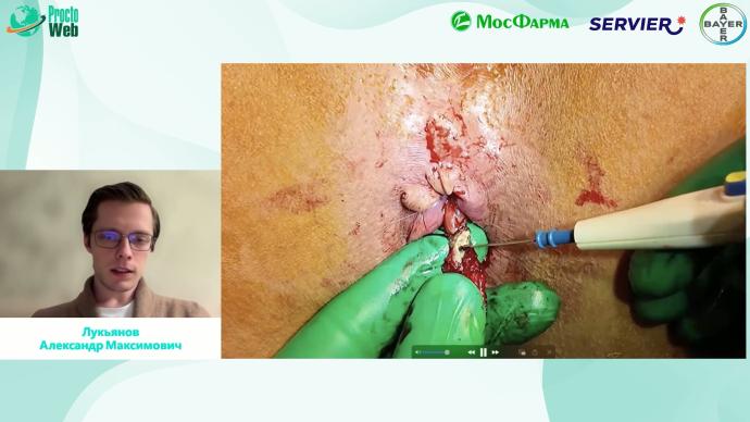 Лукьянов А.М. - Как я оперирую геморрой