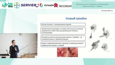 Лукьянов А.М. - Update 2025 в лечении геморроя