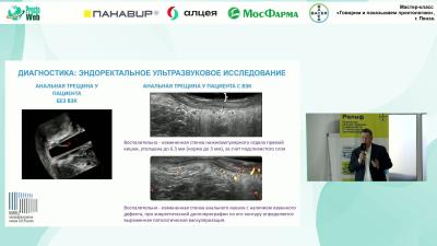 Аносов И.С. - Анальные трещины при воспалительных заболеваниях кишечника