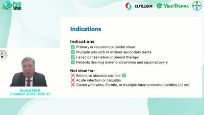 Kushal Mital - Laser in Pilonodal Sinus Disease