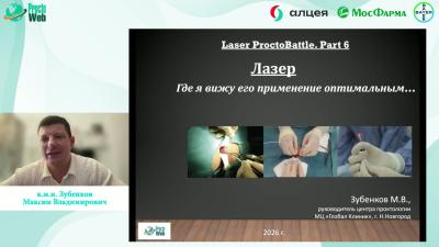 Зубенков М.В. - Лазер. Где я вижу его применение оптимальным