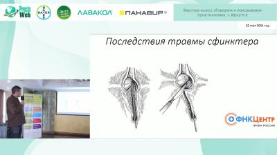 Давидович Д.Л. - Реконструктивная проктология и регенеративные технологии. Клинические примеры.