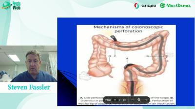 Steven Fassler - Complicatoins of Colon and Rectal Surgery