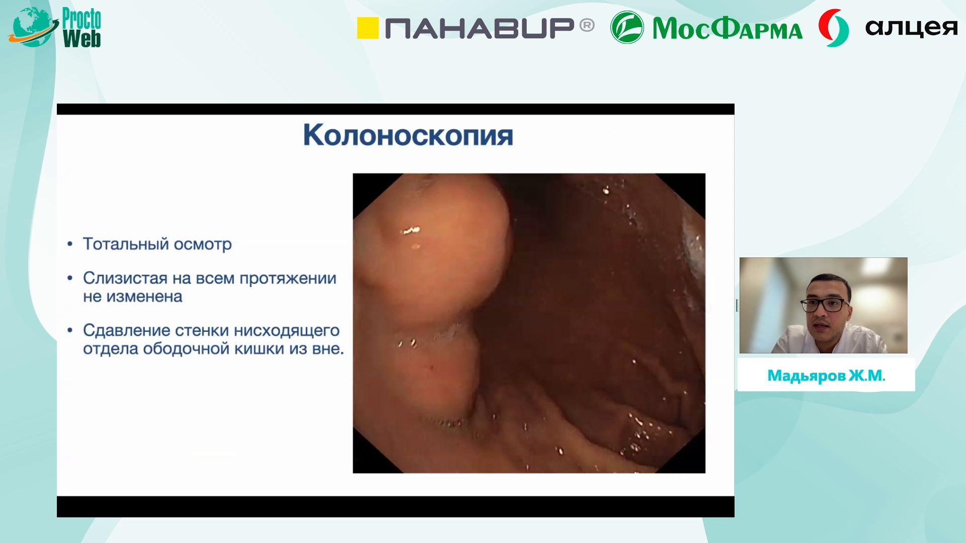 Мадьяров Ж.М. - Редкая ALK+ воспалительная миофибробластическая опухоль большого сальника