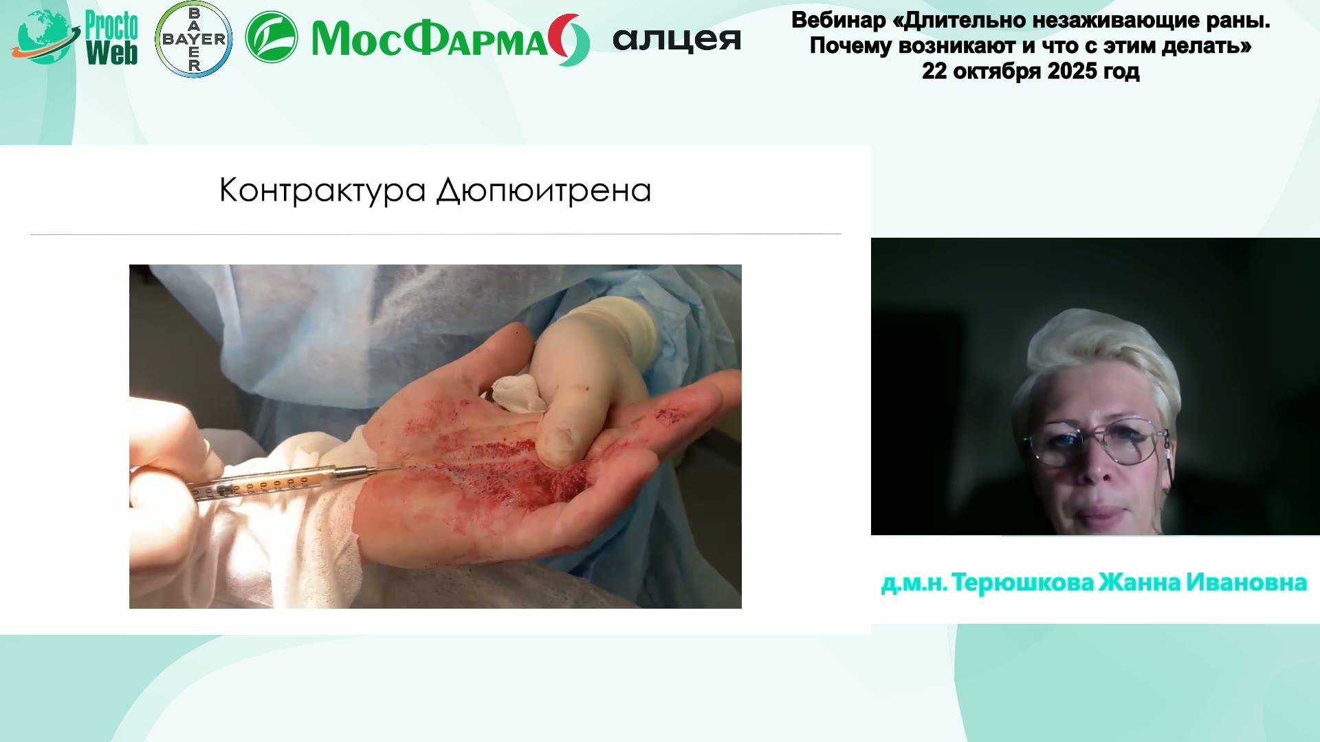 Терюшкова Ж.И. - Современные технологии в лечение постлучевых заболеваний прямой кишки