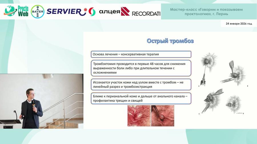 Лукьянов А.М. - Update 2025 в лечении геморроя