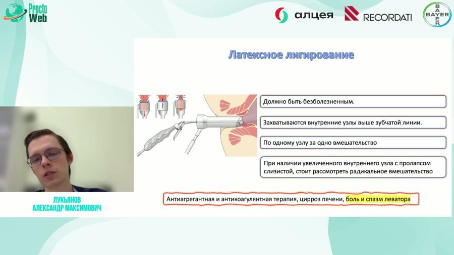 Лукьянов А.М. - Update в лечении геморроя