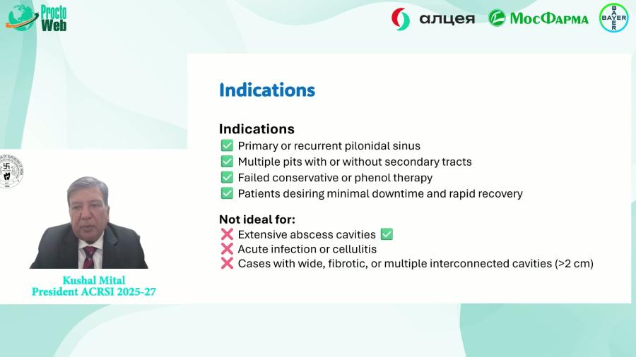 Kushal Mital - Laser in Pilonodal Sinus Disease