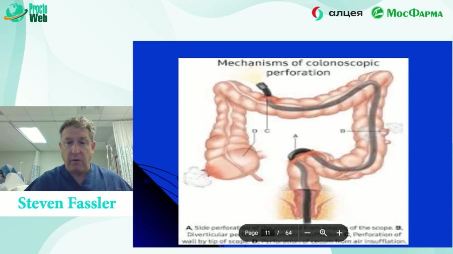 Steven Fassler - Complicatoins of Colon and Rectal Surgery
