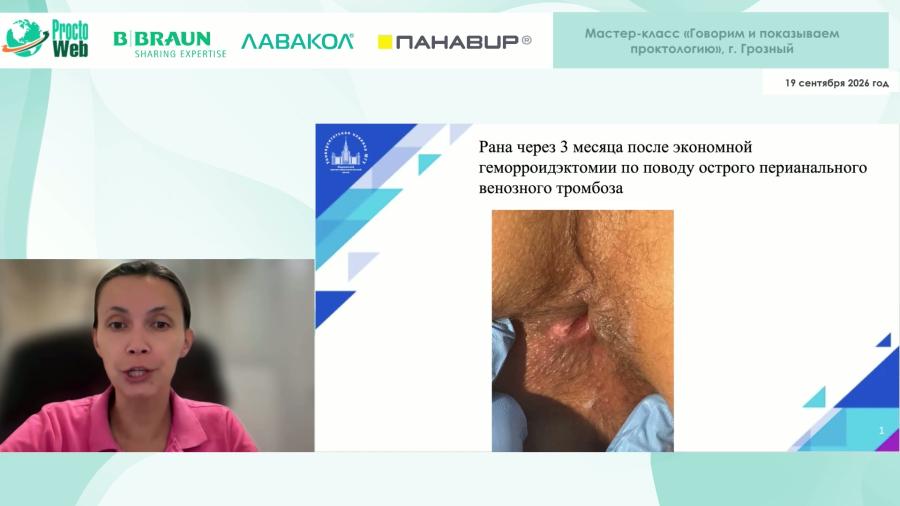 Гарманова Т.Н. - Осложнения после проктологических операций. Как не допустить и что делать