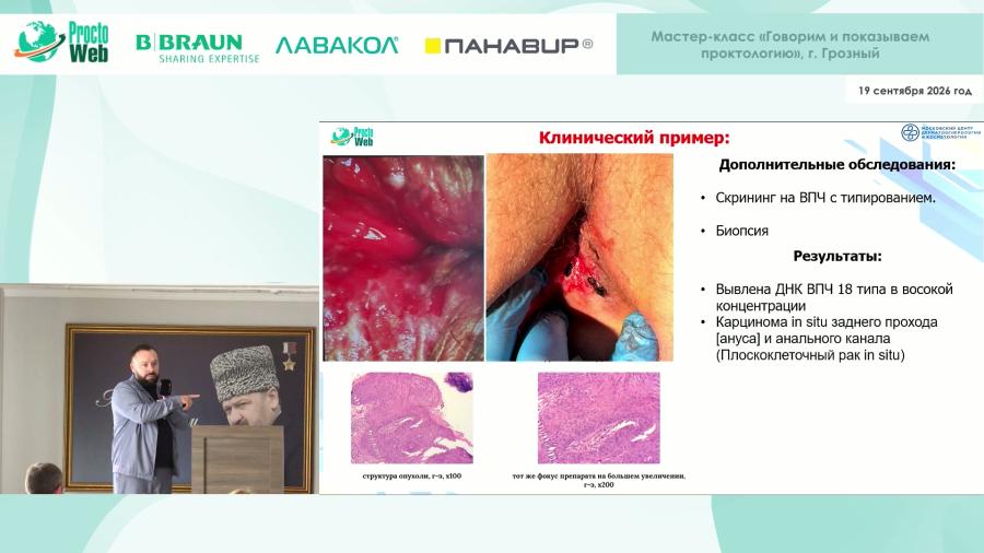 Титов И.С. - Анальная трещина. Что делать, когда стандартная терапия не работает